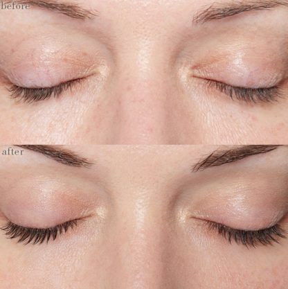 lash-before-and-after
