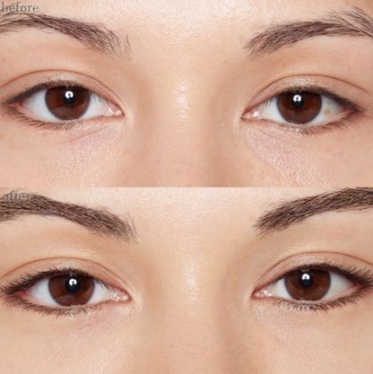 lash-before-and-after